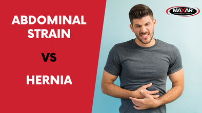 Know the Difference: Abdominal Strain VS. Hernia